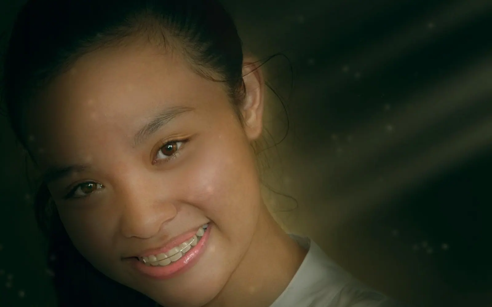 Brace, girl and dental brace